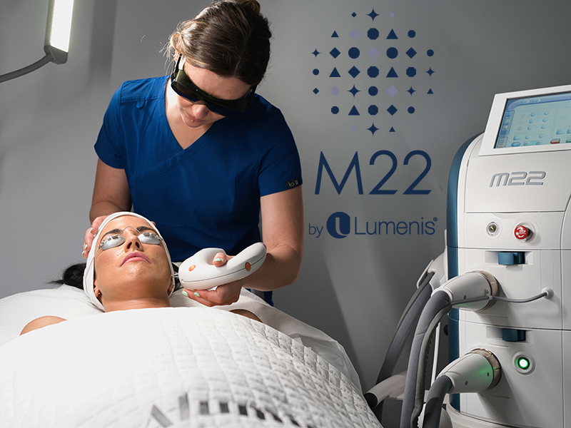 M22 IPL 光子療程